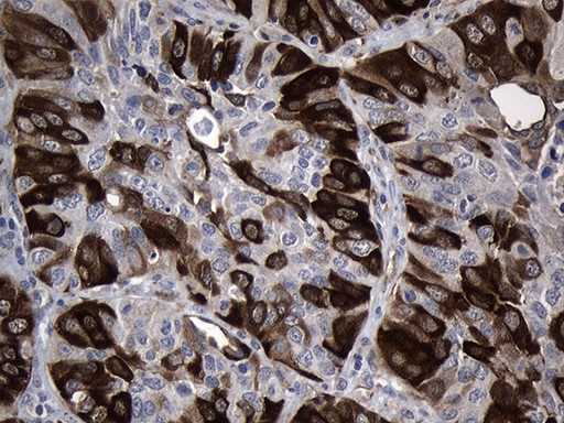 RRM2 Antibody in Immunohistochemistry (Paraffin) (IHC (P))