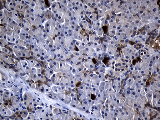 RRM2 Antibody in Immunohistochemistry (Paraffin) (IHC (P))