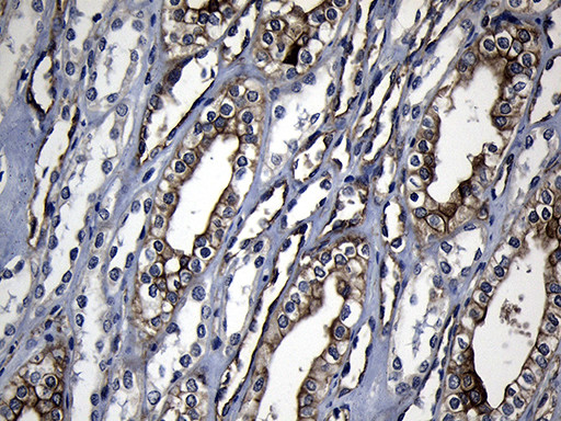 RRM2 Antibody in Immunohistochemistry (Paraffin) (IHC (P))