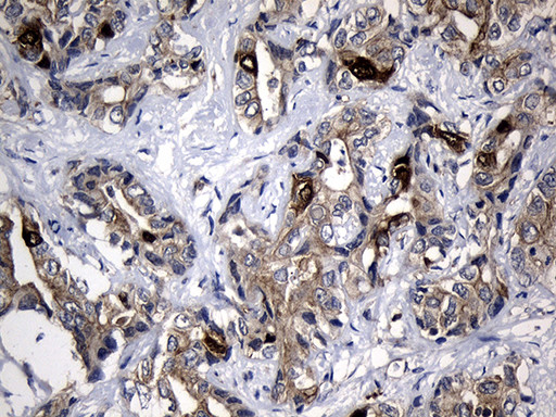 RRM2 Antibody in Immunohistochemistry (Paraffin) (IHC (P))