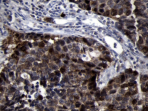 RRM2 Antibody in Immunohistochemistry (Paraffin) (IHC (P))