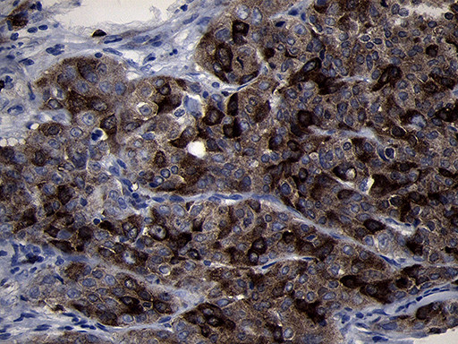 RRM2 Antibody in Immunohistochemistry (Paraffin) (IHC (P))