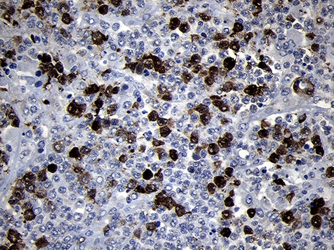 RRM2 Antibody in Immunohistochemistry (Paraffin) (IHC (P))