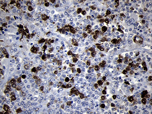 RRM2 Antibody in Immunohistochemistry (Paraffin) (IHC (P))