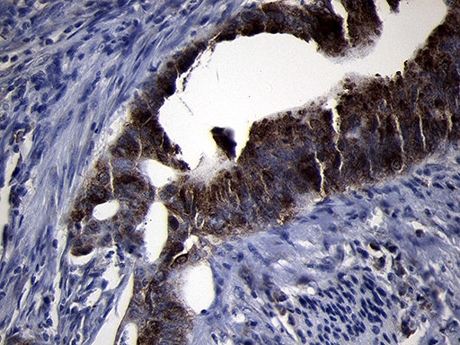 RRM2 Antibody in Immunohistochemistry (Paraffin) (IHC (P))