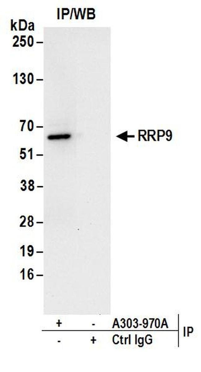 RRP9 Antibody in Western Blot (WB)