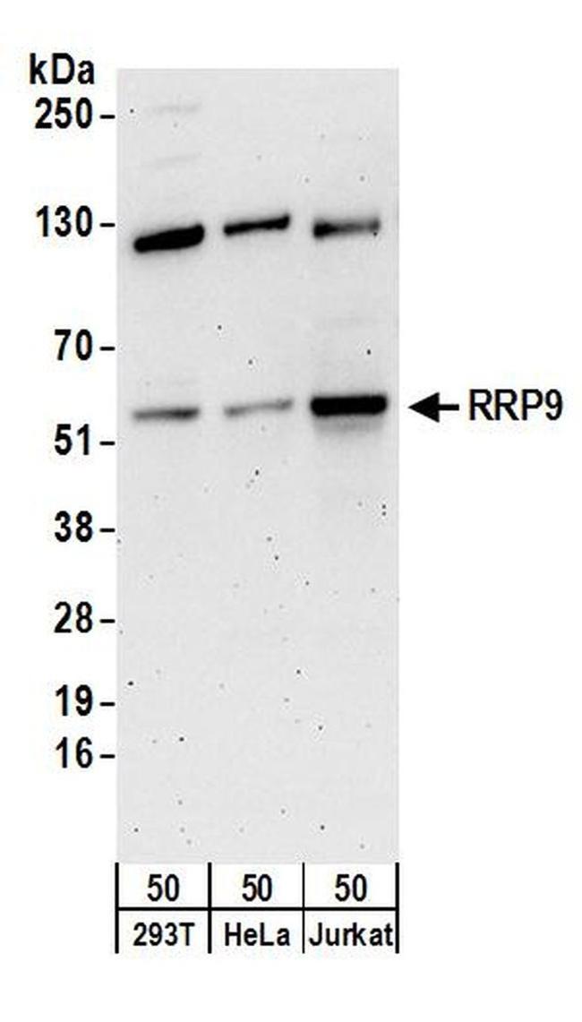 RRP9 Antibody in Western Blot (WB)