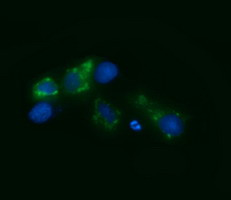 RSAD2 Antibody in Immunocytochemistry (ICC/IF)