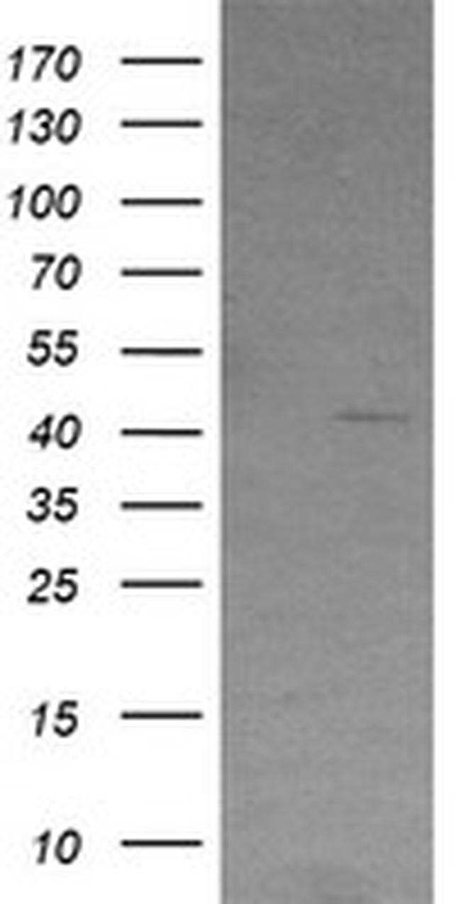 RSAD2 Antibody in Western Blot (WB)