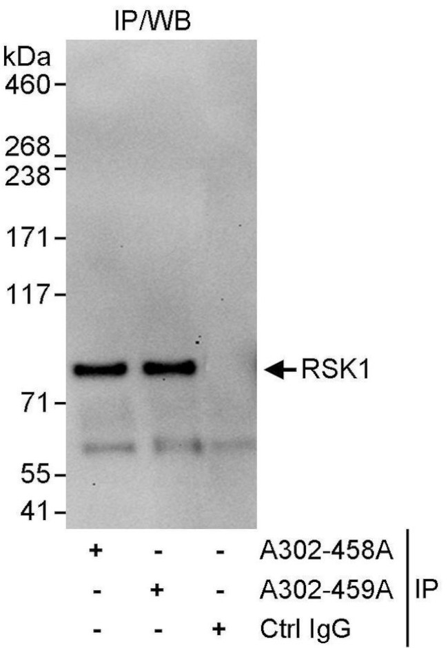 RSK1 Antibody in Immunoprecipitation (IP)