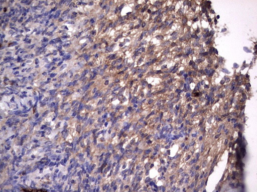 RSPO3 Antibody in Immunohistochemistry (Paraffin) (IHC (P))