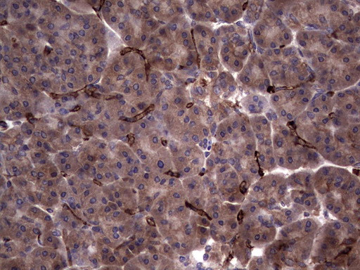 RSPO3 Antibody in Immunohistochemistry (Paraffin) (IHC (P))