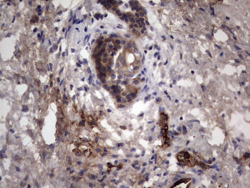 RSPO3 Antibody in Immunohistochemistry (Paraffin) (IHC (P))