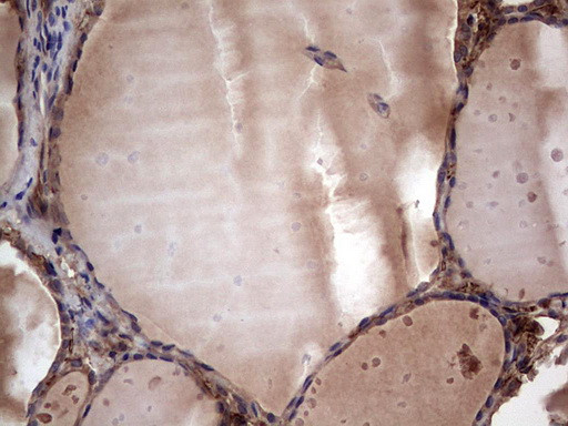 RSPO3 Antibody in Immunohistochemistry (Paraffin) (IHC (P))