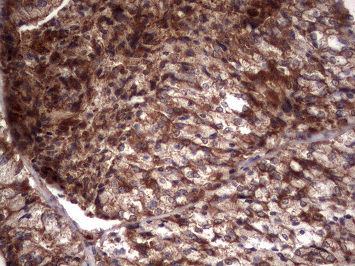 RSPO3 Antibody in Immunohistochemistry (Paraffin) (IHC (P))