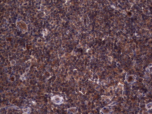 RSPO3 Antibody in Immunohistochemistry (Paraffin) (IHC (P))