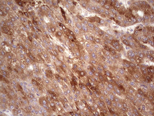 RSPO3 Antibody in Immunohistochemistry (Paraffin) (IHC (P))