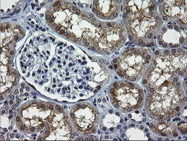 RTKN Antibody in Immunohistochemistry (Paraffin) (IHC (P))