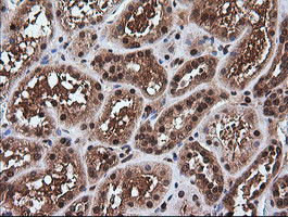 RTKN Antibody in Immunohistochemistry (Paraffin) (IHC (P))