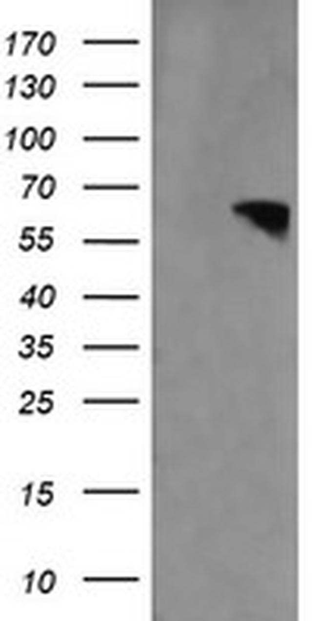 RTKN Antibody in Western Blot (WB)