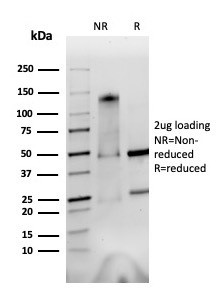 Integrin alpha V + beta 6 Antibody in SDS-PAGE (SDS-PAGE)