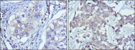 RTN3 Antibody in Immunohistochemistry (Paraffin) (IHC (P))