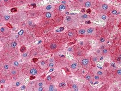 RTN3 Antibody in Immunohistochemistry (Paraffin) (IHC (P))