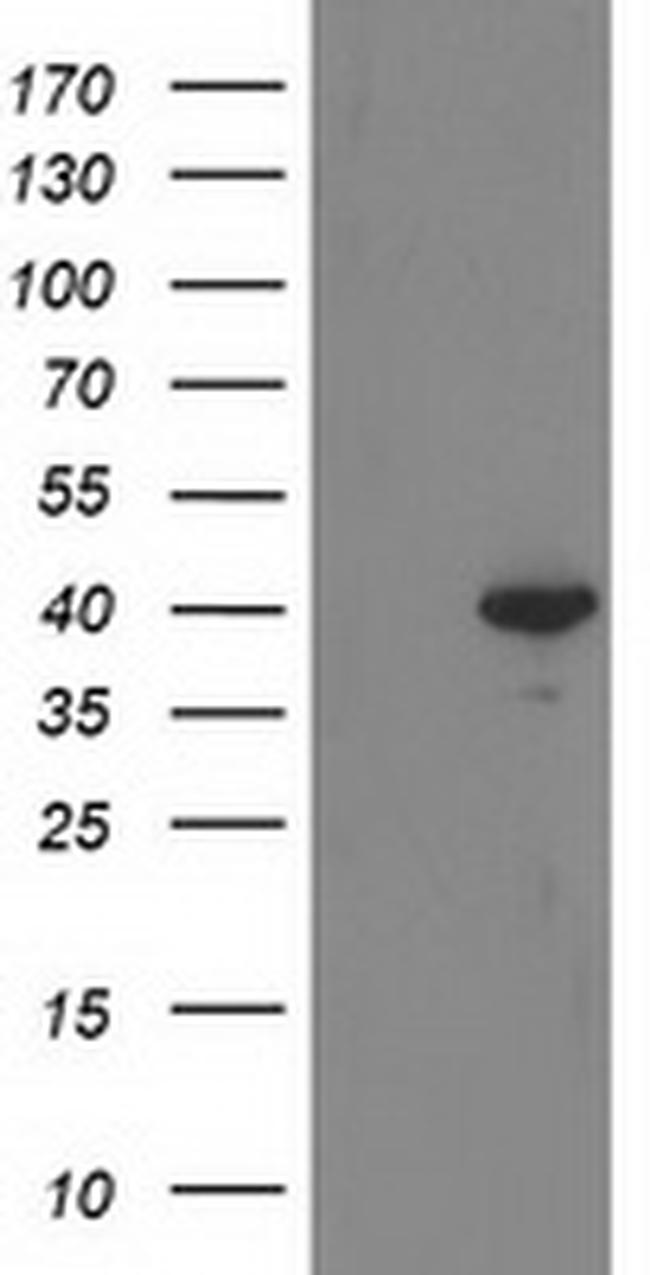 RTN4IP1 Antibody in Western Blot (WB)