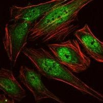 RUNX1 Antibody in Immunocytochemistry (ICC/IF)