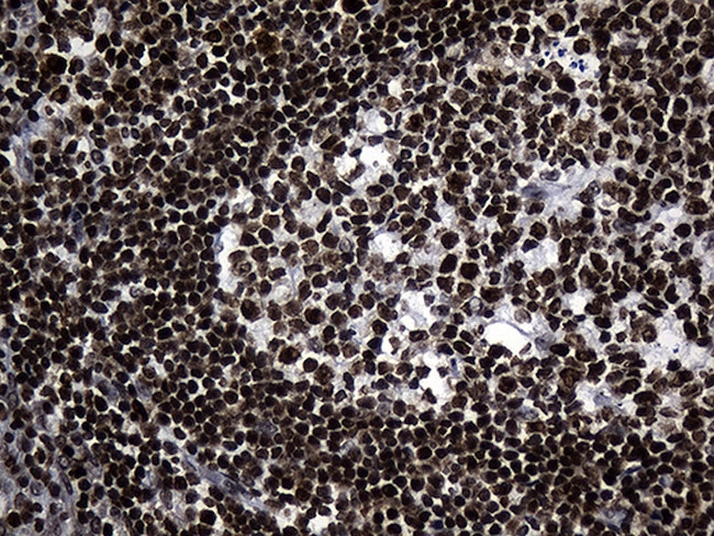 RUNX3 Antibody in Immunohistochemistry (Paraffin) (IHC (P))