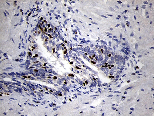 RUNX3 Antibody in Immunohistochemistry (Paraffin) (IHC (P))