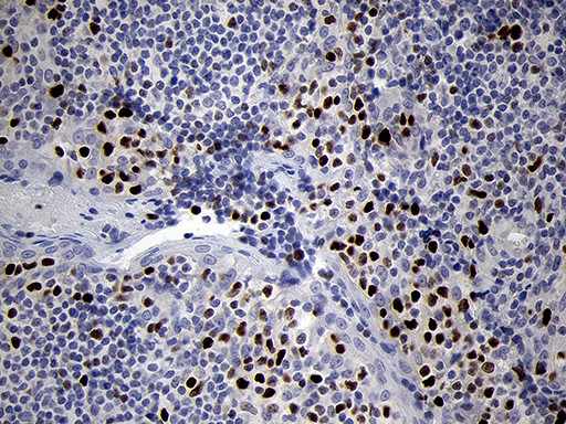 RUNX3 Antibody in Immunohistochemistry (Paraffin) (IHC (P))