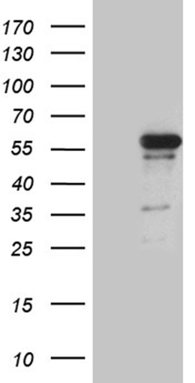 RUNX3 Antibody in Western Blot (WB)