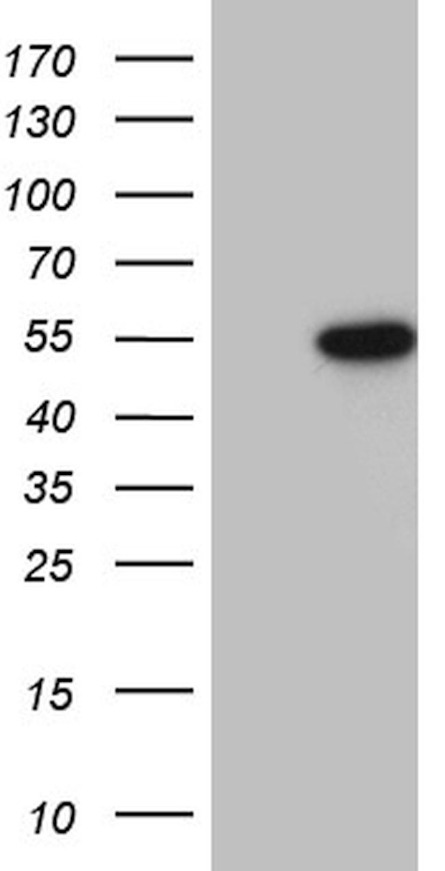 RUNX3 Antibody in Western Blot (WB)