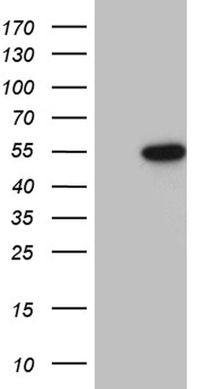 RUNX3 Antibody in Western Blot (WB)