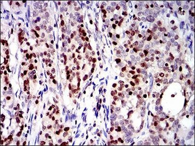 RUNX3 Antibody in Immunohistochemistry (Paraffin) (IHC (P))