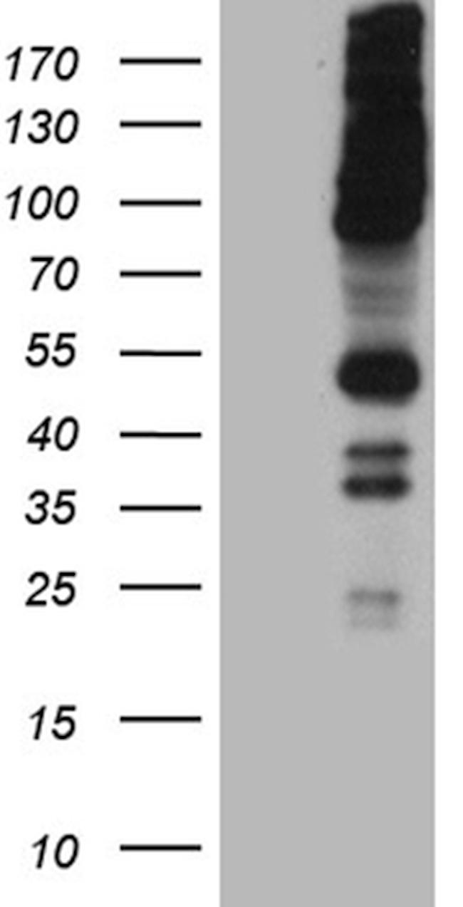 RUSC2 Antibody in Western Blot (WB)