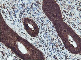 RUVBL2 Antibody in Immunohistochemistry (Paraffin) (IHC (P))