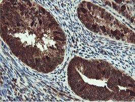 RUVBL2 Antibody in Immunohistochemistry (Paraffin) (IHC (P))