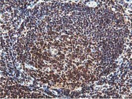 RUVBL2 Antibody in Immunohistochemistry (Paraffin) (IHC (P))