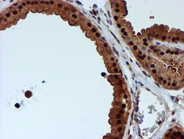 RUVBL2 Antibody in Immunohistochemistry (Paraffin) (IHC (P))