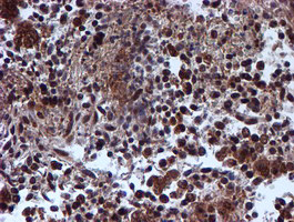 RUVBL2 Antibody in Immunohistochemistry (Paraffin) (IHC (P))