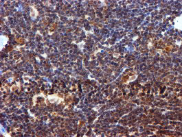 RUVBL2 Antibody in Immunohistochemistry (Paraffin) (IHC (P))