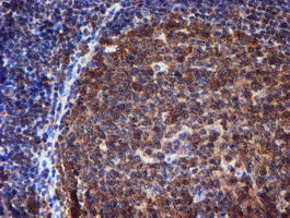 RUVBL2 Antibody in Immunohistochemistry (Paraffin) (IHC (P))