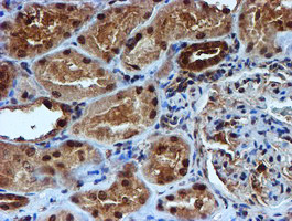 RUVBL2 Antibody in Immunohistochemistry (Paraffin) (IHC (P))