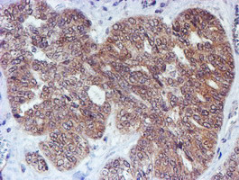 RUVBL2 Antibody in Immunohistochemistry (Paraffin) (IHC (P))