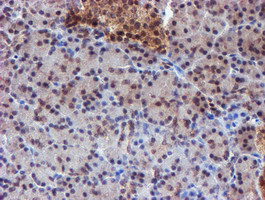 RUVBL2 Antibody in Immunohistochemistry (Paraffin) (IHC (P))