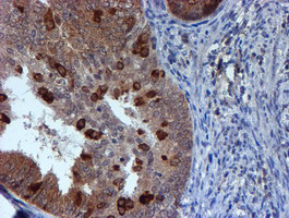 RUVBL2 Antibody in Immunohistochemistry (Paraffin) (IHC (P))