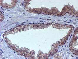 RUVBL2 Antibody in Immunohistochemistry (Paraffin) (IHC (P))