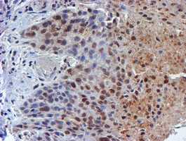 RUVBL2 Antibody in Immunohistochemistry (Paraffin) (IHC (P))